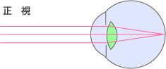 正視の図